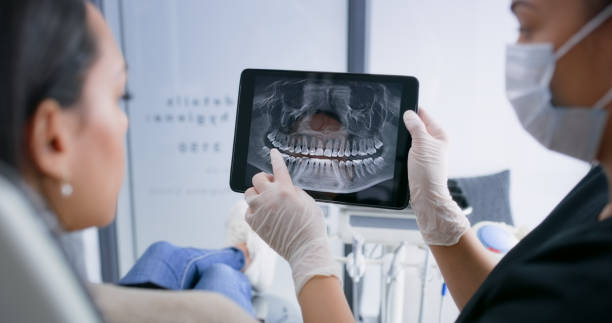 Licensed Dental Veneers service in Pond Creek, OK - Smile Center Dentistry